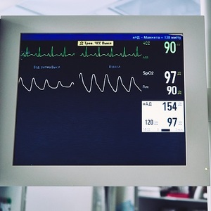 heart monitor electrocardiogram